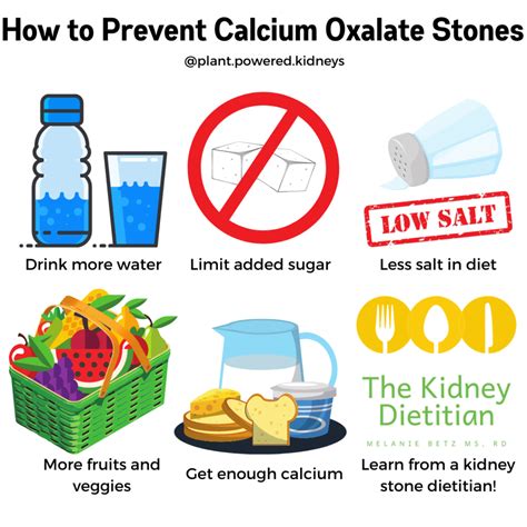 drinks for calcium kidney stones.